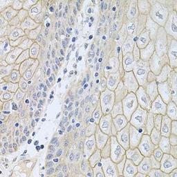 Immunohistochemical staining of mouse lung tissue using NCR3 antibody (dilution of 1:100)