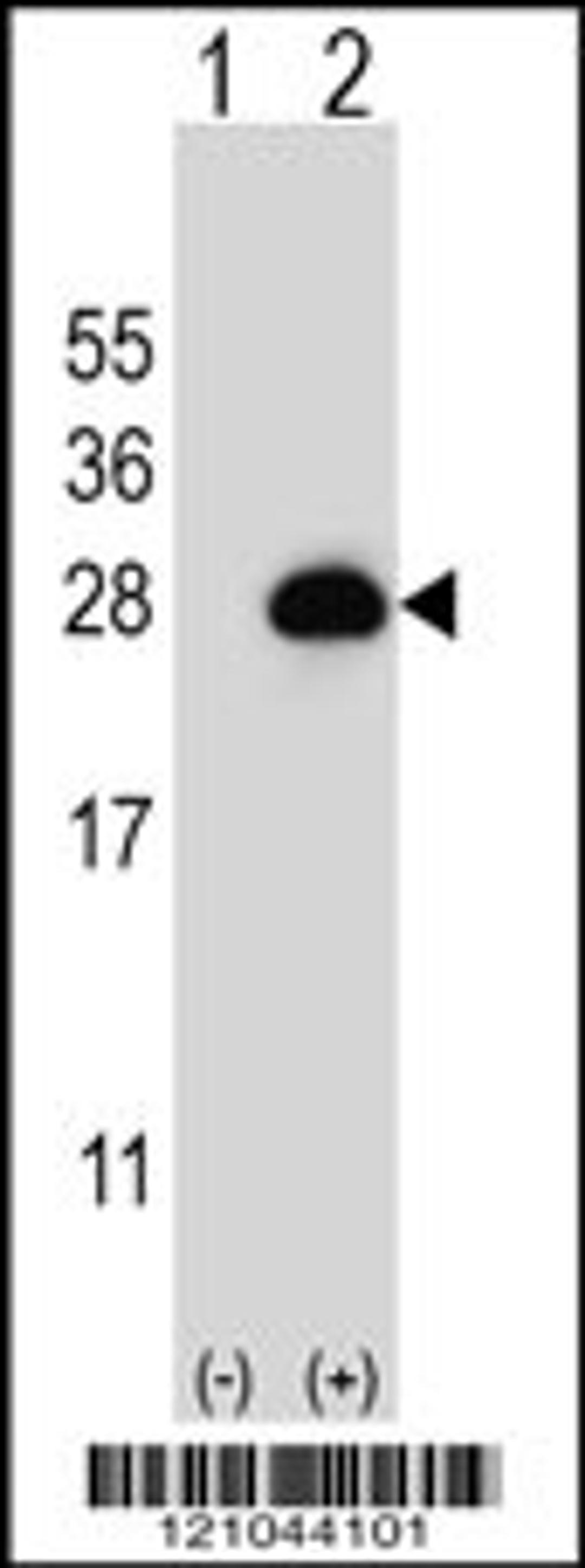 Western blot analysis of RAB3B using rabbit polyclonal RAB3B Antibody using 293 cell lysates (2 ug/lane) either nontransfected (Lane 1) or transiently transfected (Lane 2) with the RAB3B gene.