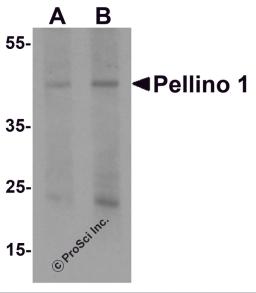 Western blot analysis of Pellino 1 in human liver tissue lysate with Pellino 1 antibody at (A) 1 and (B) 2 &#956;g/mL.