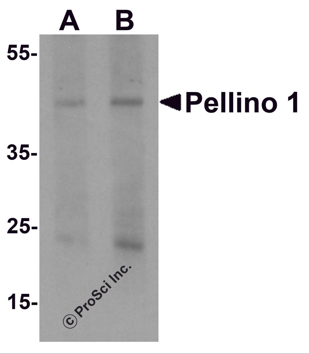 Western blot analysis of Pellino 1 in human liver tissue lysate with Pellino 1 antibody at (A) 1 and (B) 2 μg/mL.