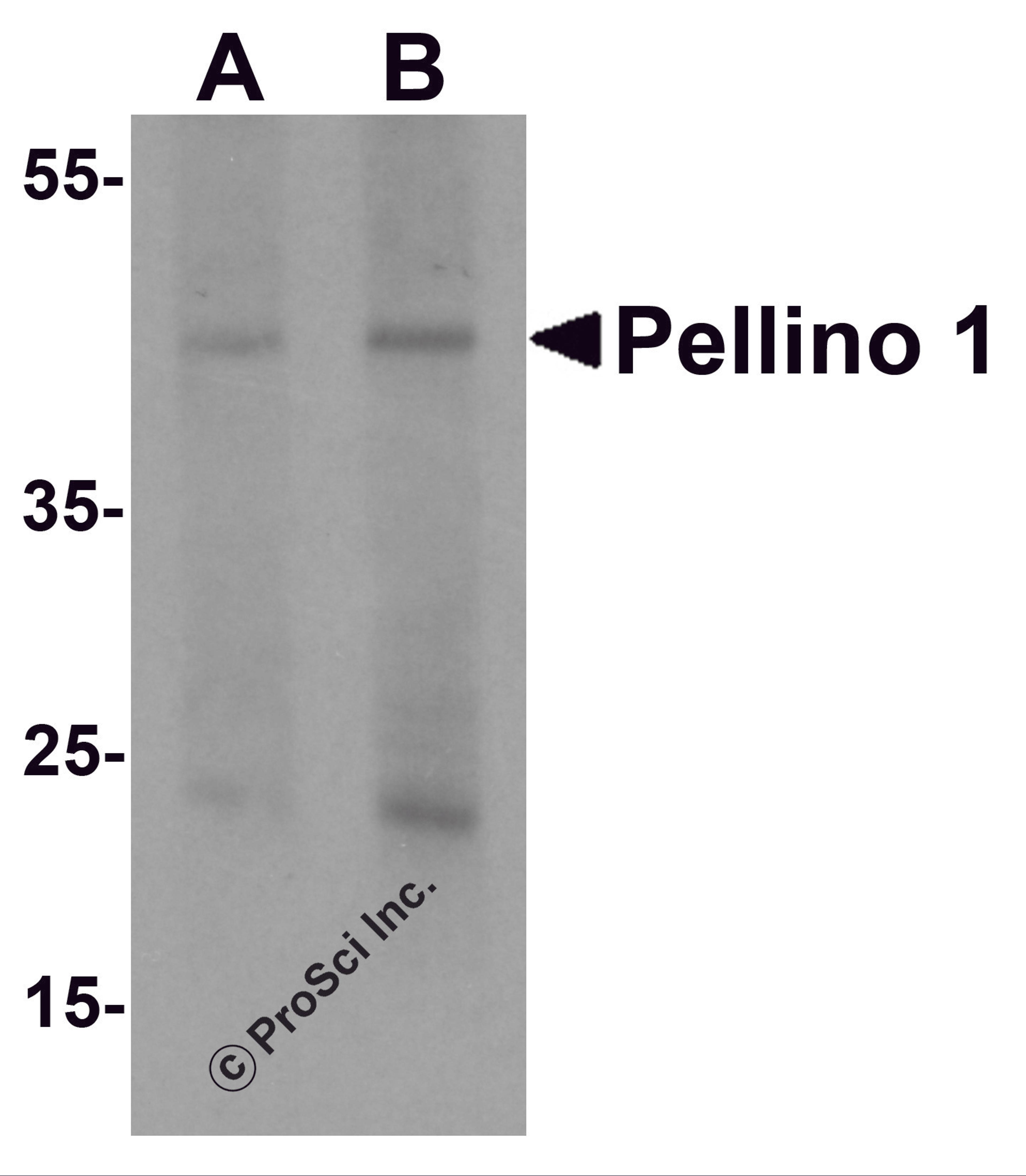 Western blot analysis of Pellino 1 in human liver tissue lysate with Pellino 1 antibody at (A) 1 and (B) 2 μg/mL.