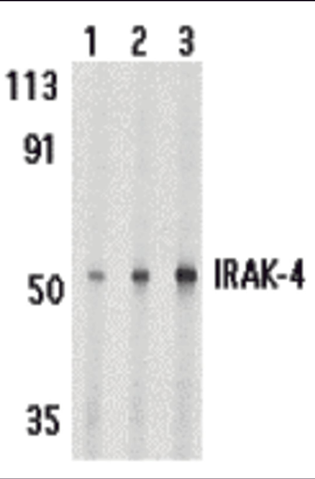 Western blot analysis of IRAK-4 in HeLa cell lysate with IRAK-4 antibody at 1 (lane 1), 2 (lane 2), and 4 (lane 3) μg/mL, respectively.