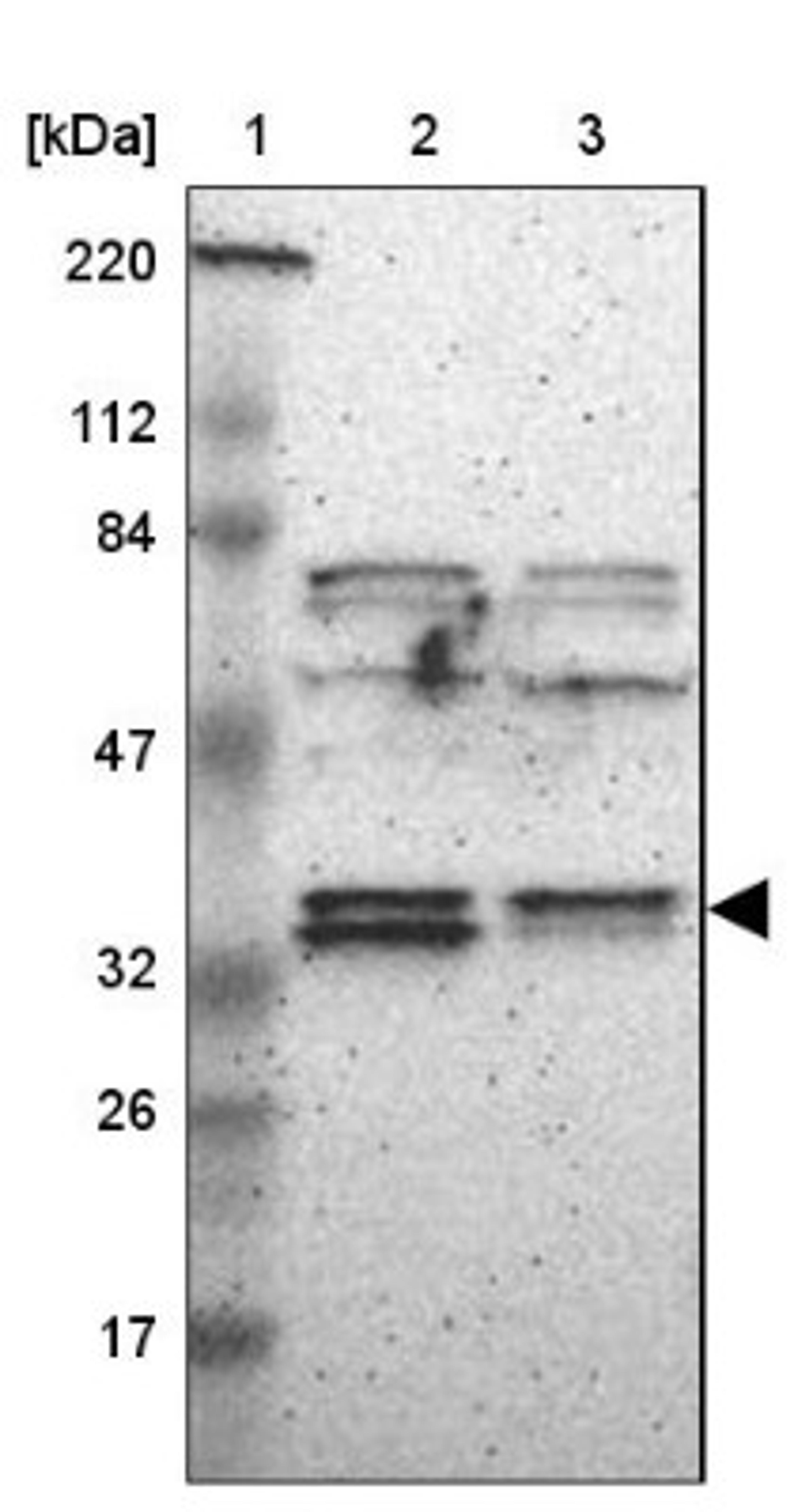 Western Blot: ASB8 Antibody [NBP1-83620] - Lane 1: Marker [kDa] 220, 112, 84, 47, 32, 26, 17<br/>Lane 2: Human cell line RT-4<br/>Lane 3: Human cell line U-251MG sp