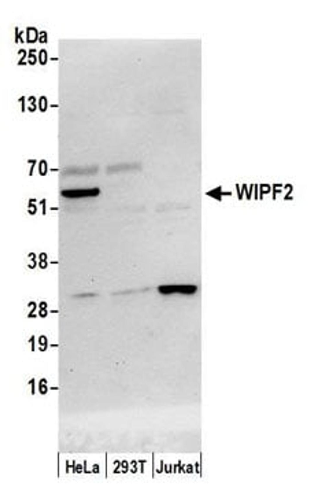 Detection of human WIPF2 by western blot.