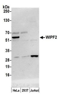 Detection of human WIPF2 by western blot.