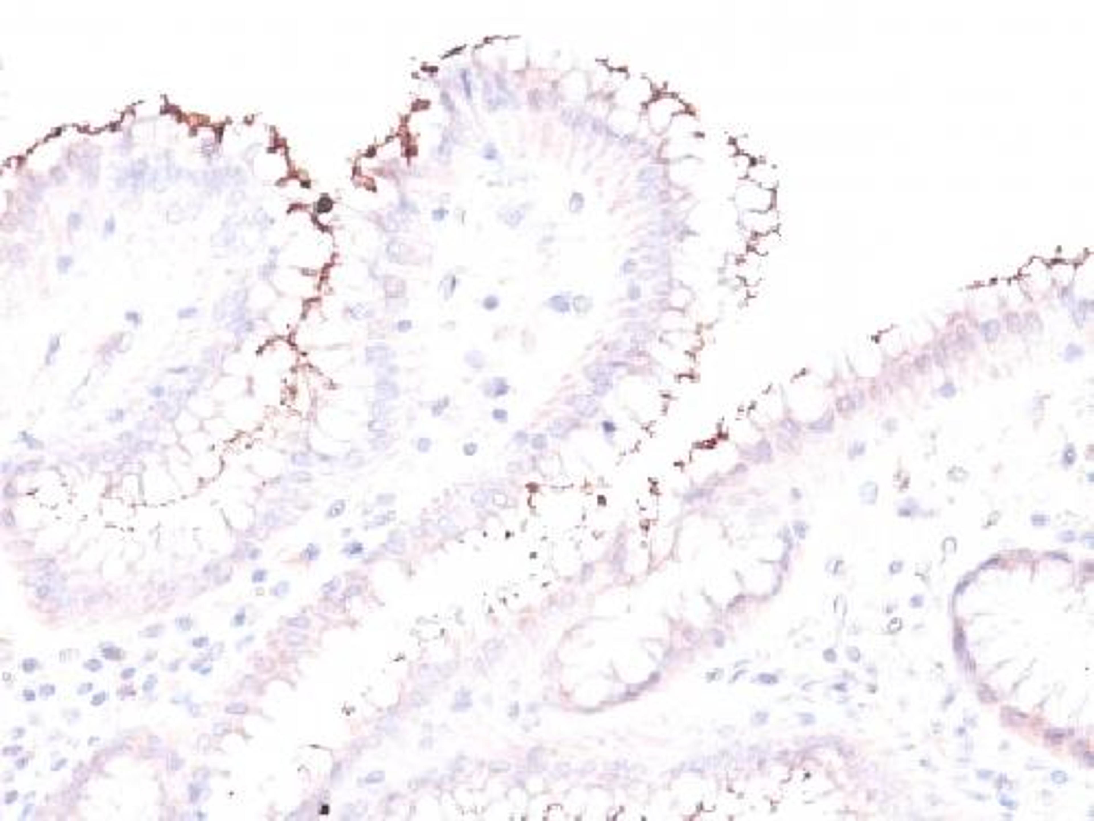 Immunohistochemical staining of human Stomach tissue using Helicobacter Pylori antibody