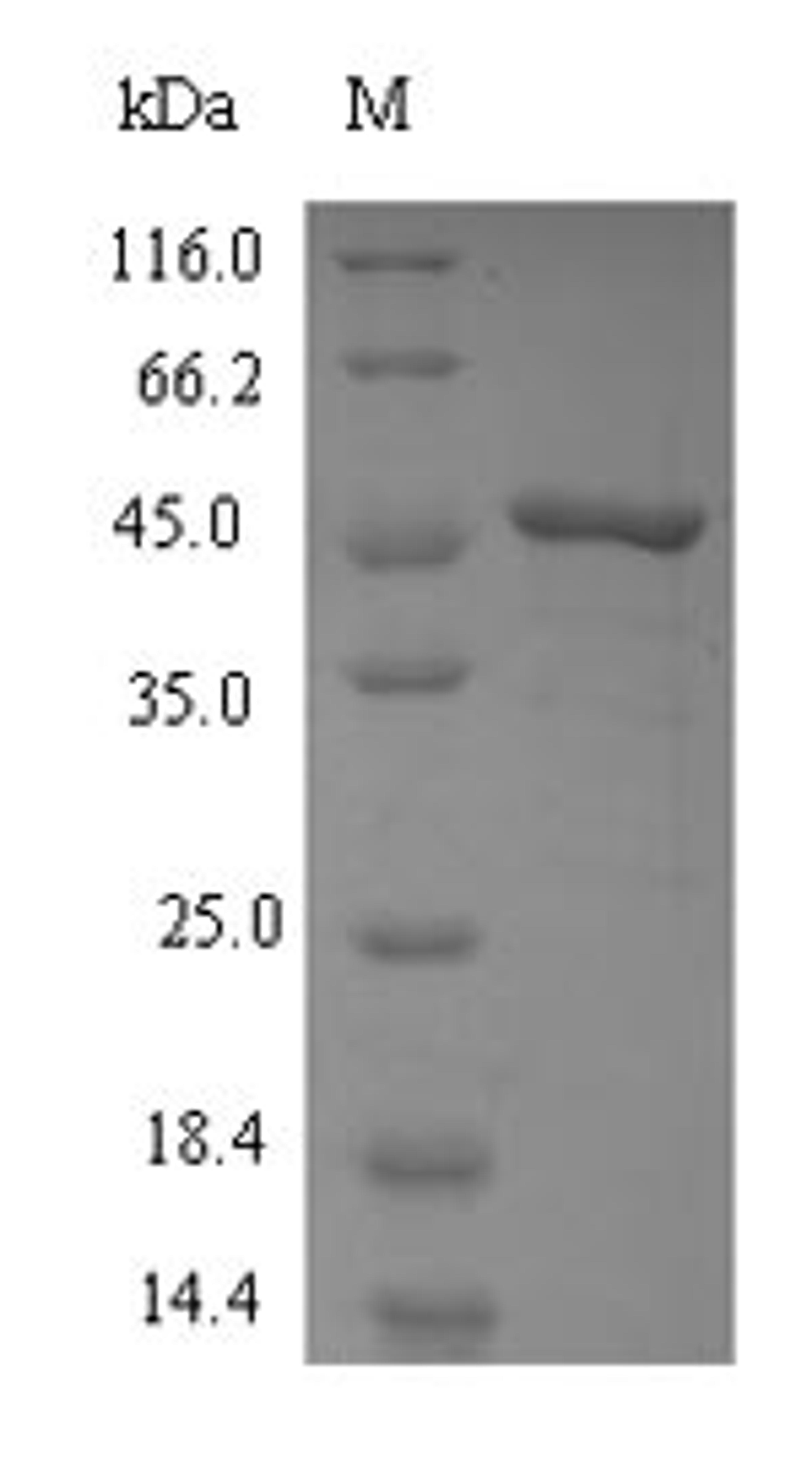 (Tris-Glycine gel) Discontinuous SDS-PAGE (reduced) with 5% enrichment gel and 15% separation gel.