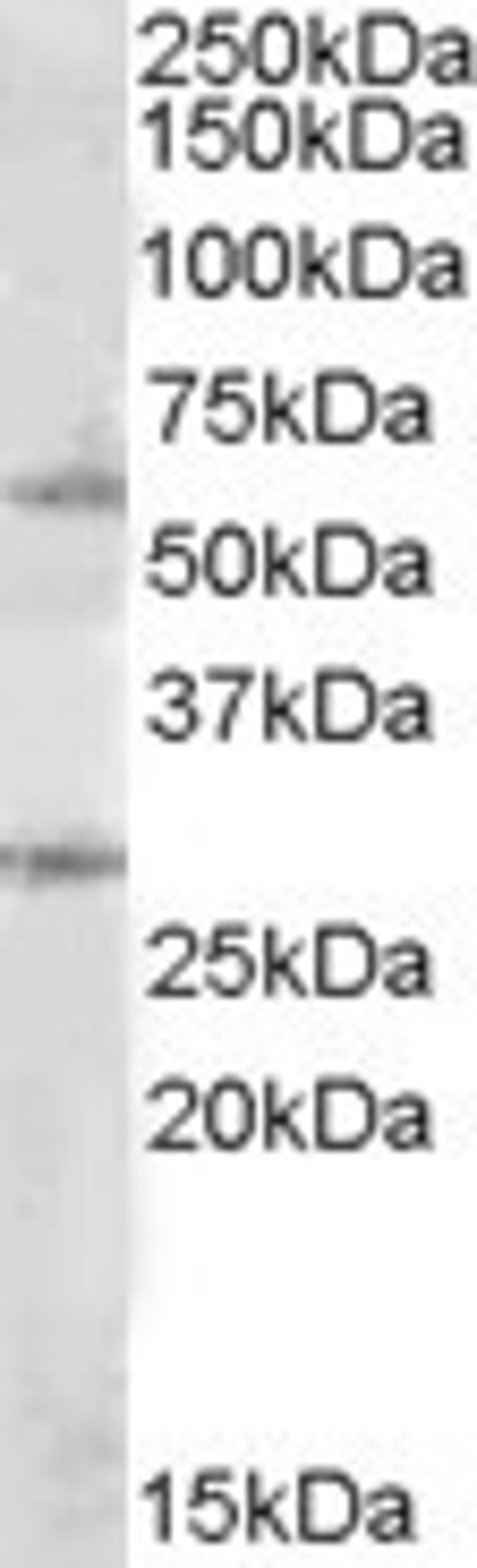 46-764 (1ug/ml) staining of Daudi lysate (35ug protein in RIPA buffer). Primary incubation was 1 hour. Detected by chemiluminescence.