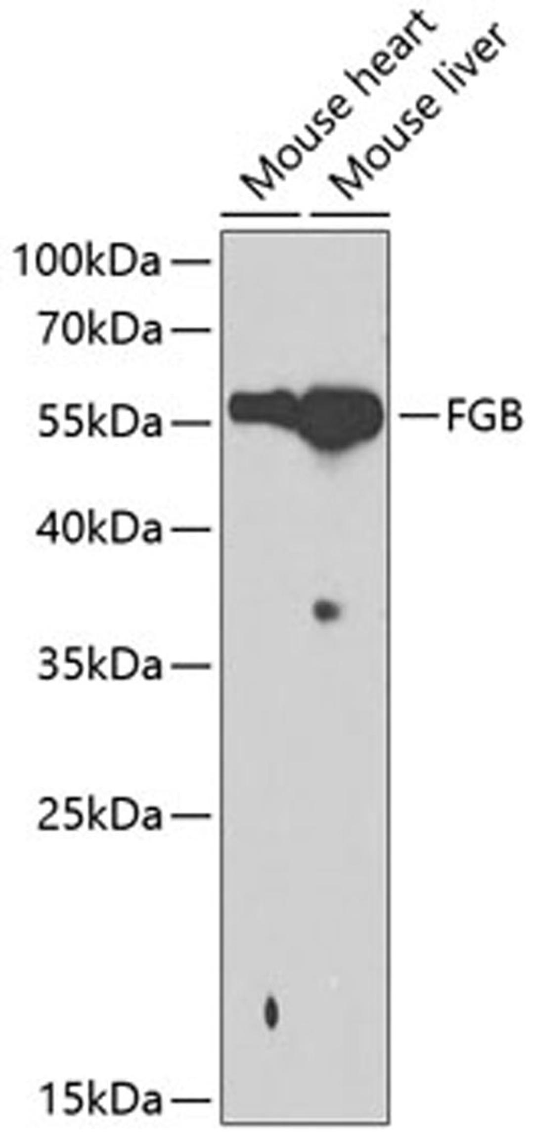 Western blot - FGB antibody (A1401)