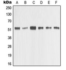 Western blot analysis of HeLa (Lane 1), MCF7 (Lane 2), MDAMB435 (Lane 3), Raw264.7 (Lane 4), PC12 (Lane 5), NIH3T3 (Lane 6) whole cell lysates using MMP1 antibody