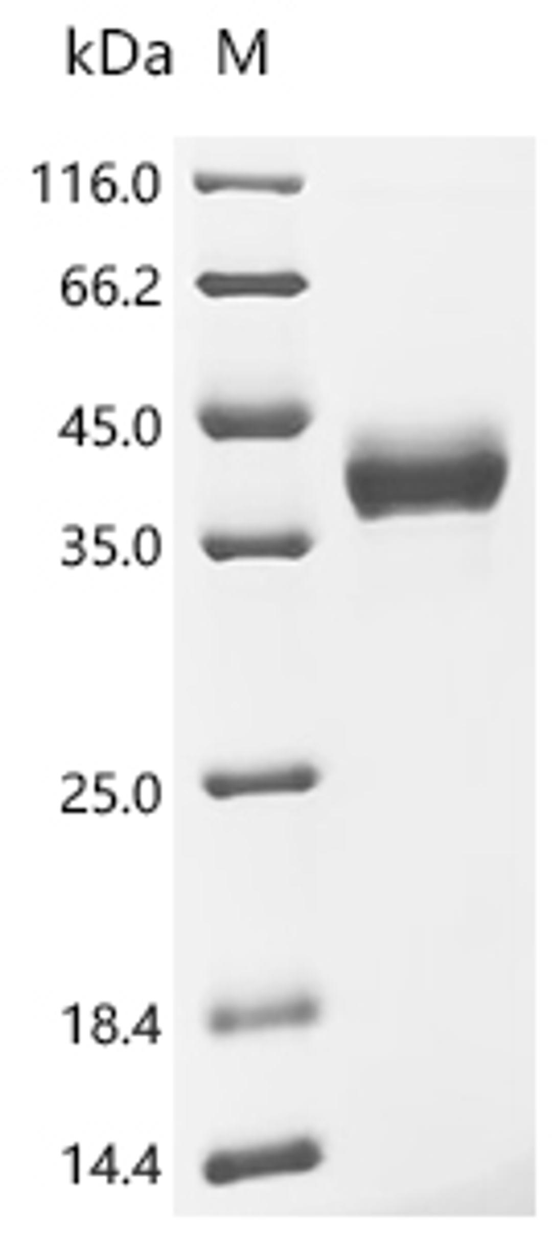 (Tris-Glycine gel) Discontinuous SDS-PAGE (reduced) with 5% enrichment gel and 15% separation gel.