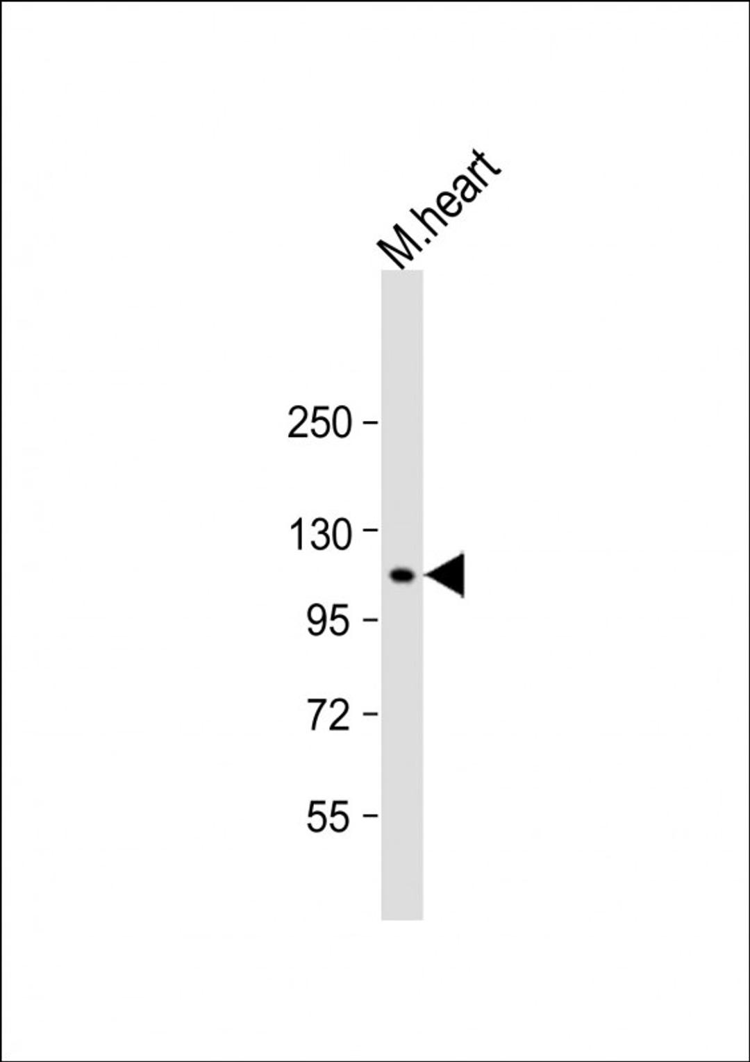 Western Blot at 1:1000 dilution + mouse heart lysate Lysates/proteins at 20 ug per lane.