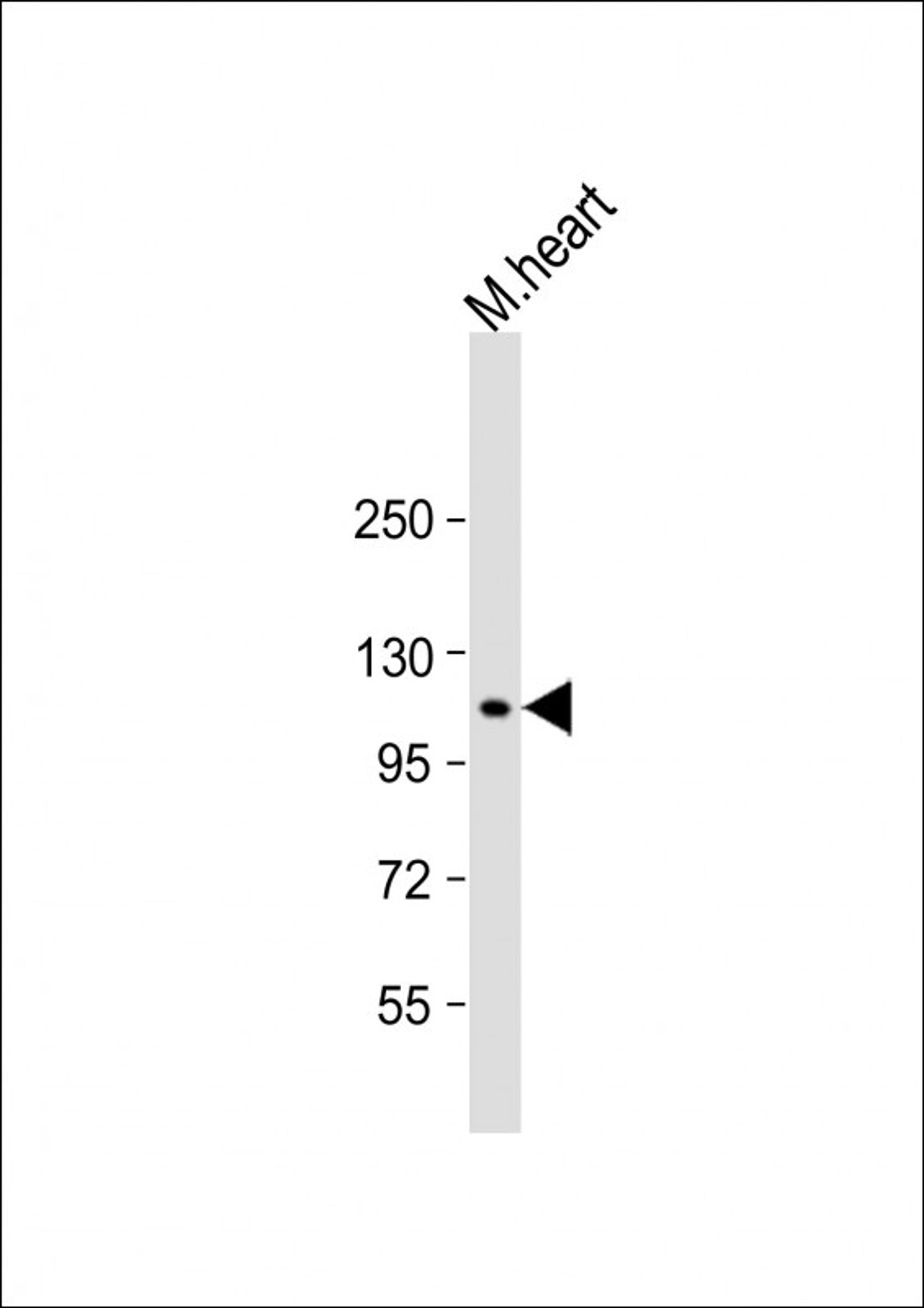 Western Blot at 1:1000 dilution + mouse heart lysate Lysates/proteins at 20 ug per lane.