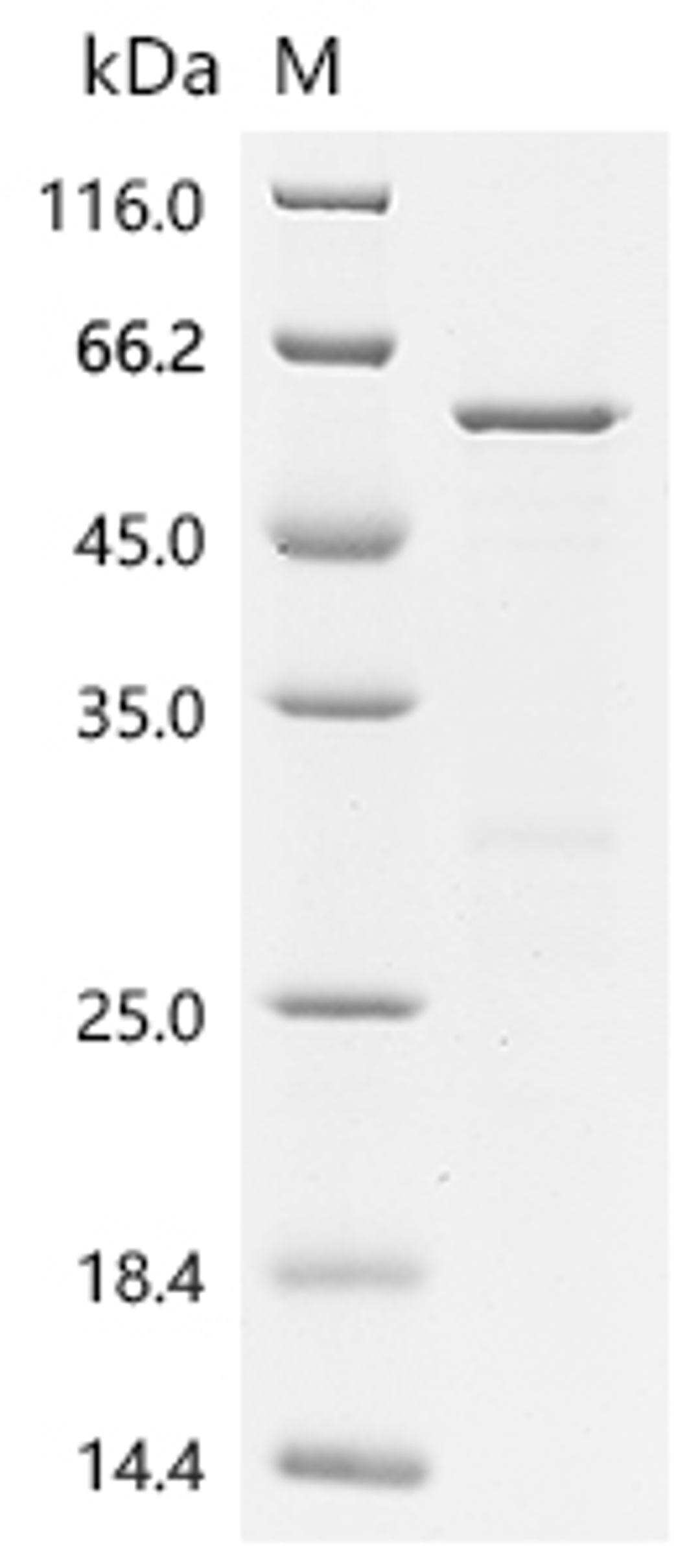 (Tris-Glycine gel) Discontinuous SDS-PAGE (reduced) with 5% enrichment gel and 15% separation gel.