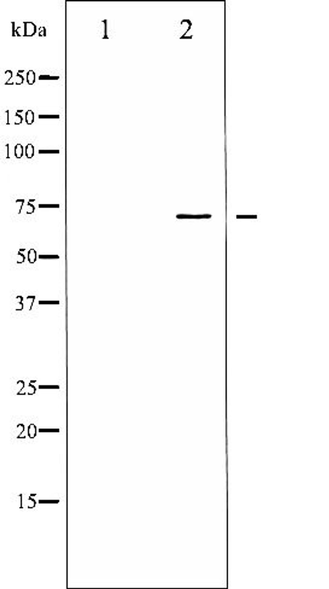 Western blot analysis of HeLa whole cell lysates using LIMK1/2 (Phospho-Thr508/505) antibody