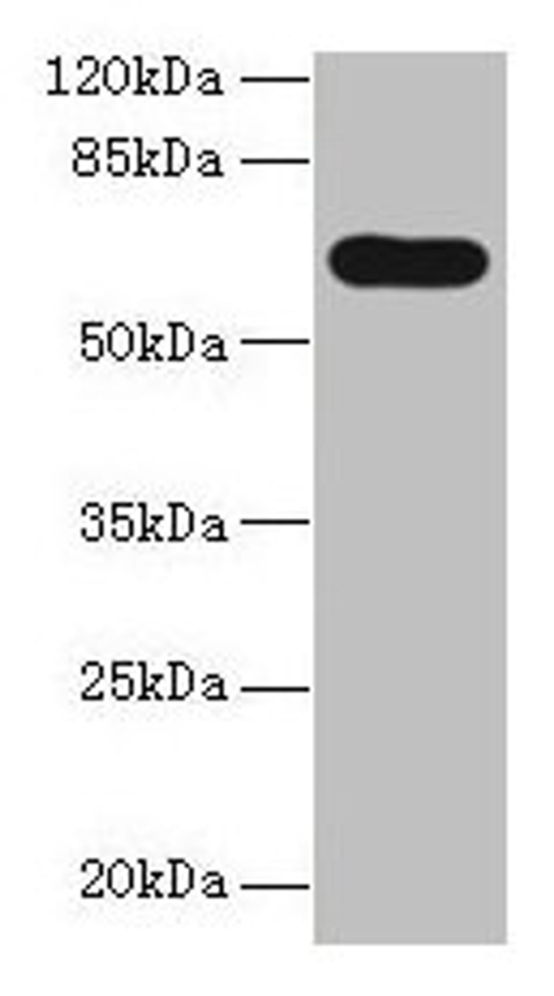Western blot. All lanes: PTPN5 antibody at 12µg/ml + HepG2 whole cell lysate. Secondary. Goat polyclonal to rabbit IgG at 1/10000 dilution. Predicted band size: 64, 61 kDa. Observed band size: 64 kDa