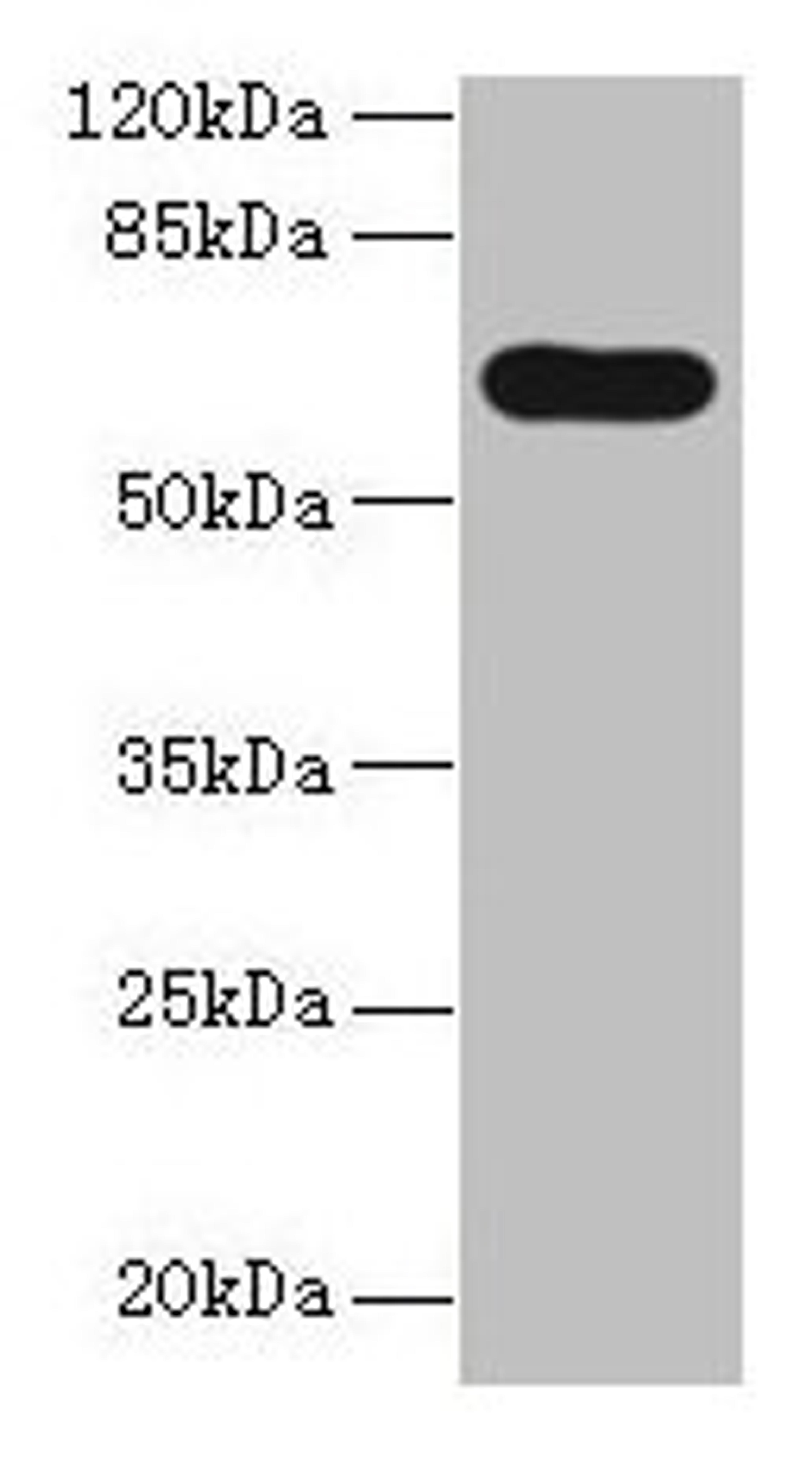 Western blot. All lanes: PTPN5 antibody at 12µg/ml + HepG2 whole cell lysate. Secondary. Goat polyclonal to rabbit IgG at 1/10000 dilution. Predicted band size: 64, 61 kDa. Observed band size: 64 kDa