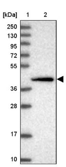 Western Blot: SCRT1 Antibody [NBP1-92369] - Lane 1: Marker [kDa] 250, 130, 95, 72, 55, 36, 28, 17, 10<br/>Lane 2: Human cell line RT-4