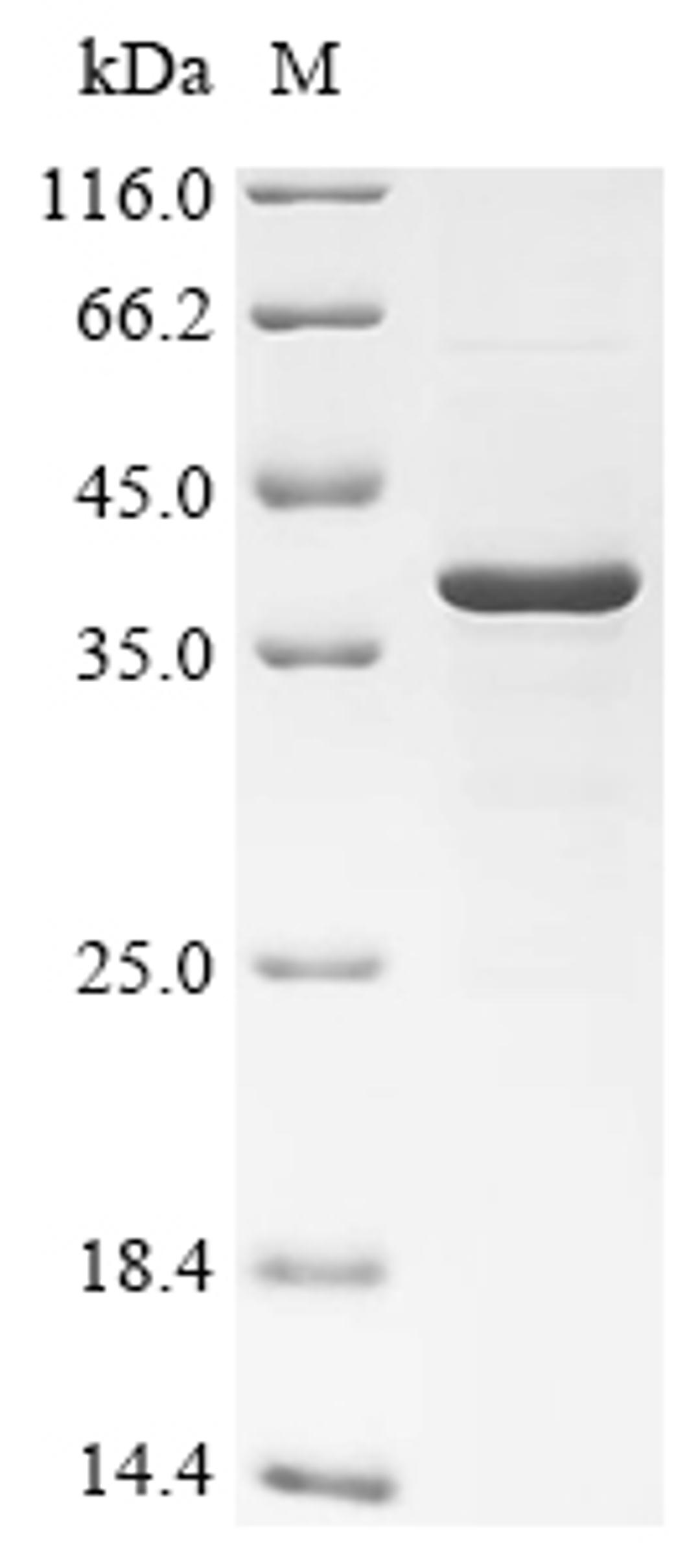 (Tris-Glycine gel) Discontinuous SDS-PAGE (reduced) with 5% enrichment gel and 15% separation gel.