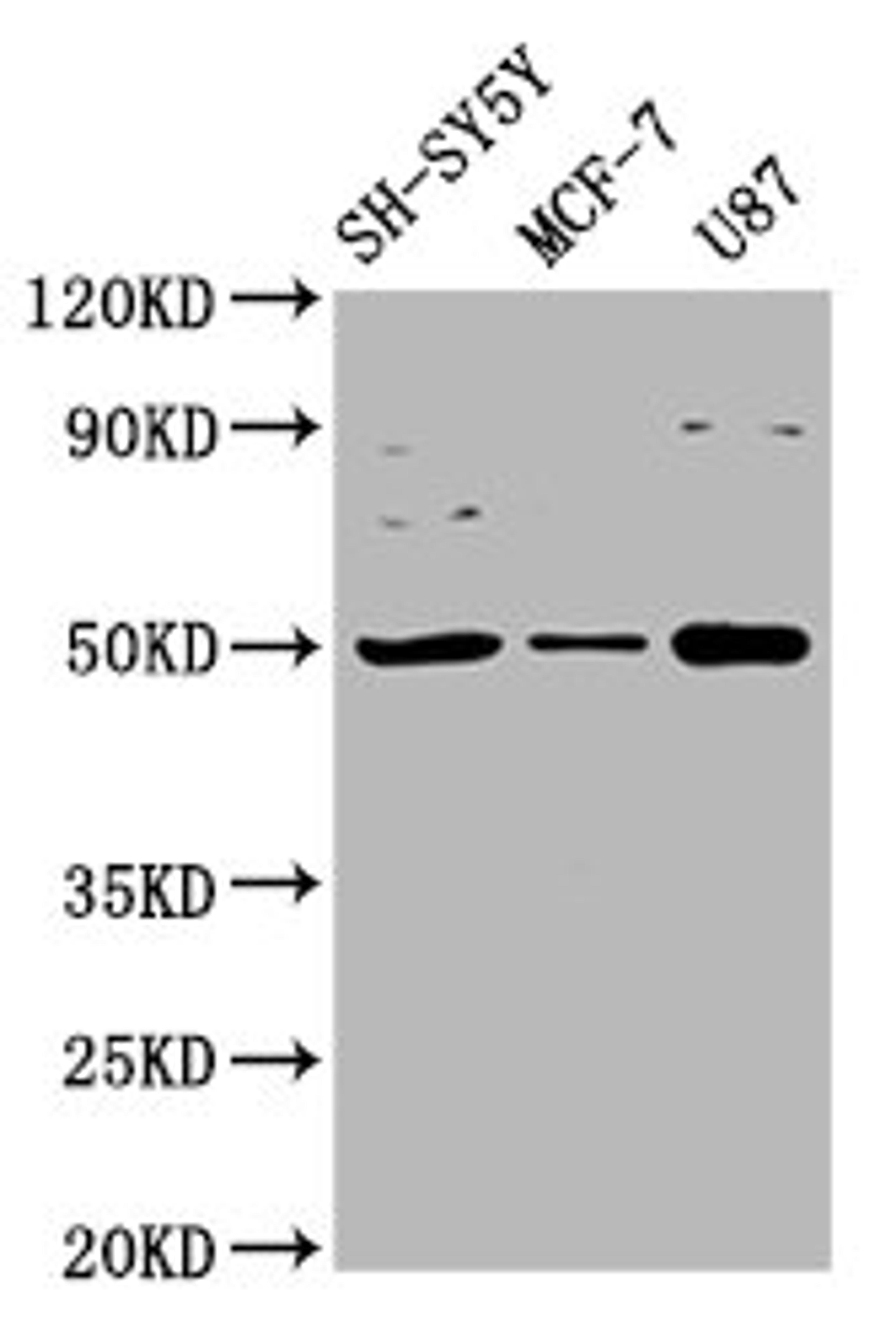 Western Blot. Positive WB detected in: SH-SY5Y whole cell lysate, MCF-7 whole cell lysate, U87 whole cell lysate. All lanes: IGHM antibody at 3.4µg/ml. Secondary. Goat polyclonal to rabbit IgG at 1/50000 dilution. Predicted band size: 50, 52 kDa. Observed band size: 50 kDa