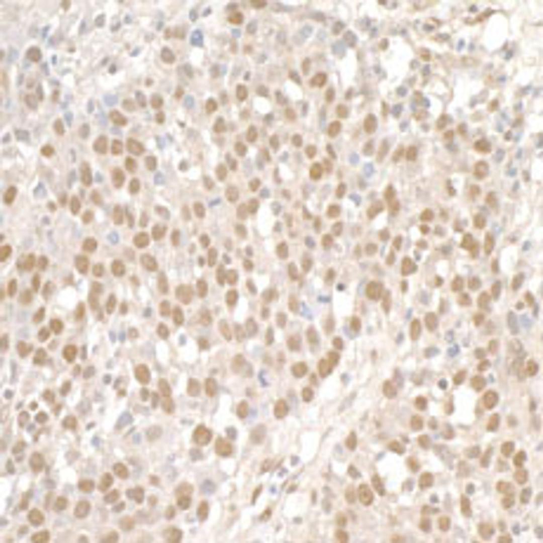 Detection of human SMC1 by immunohistochemistry.