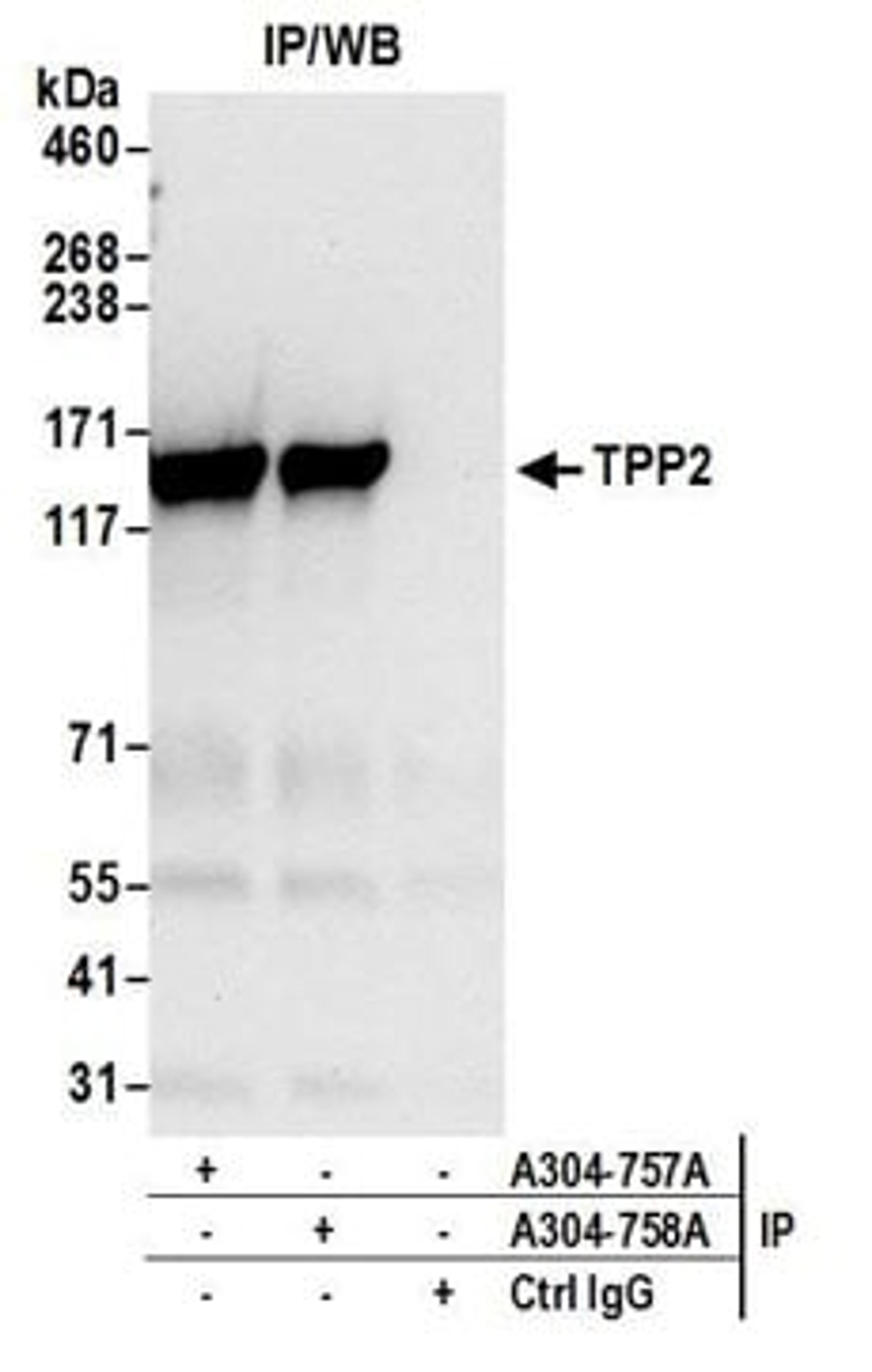 Detection of human TPP2 by western blot of immunoprecipitates.