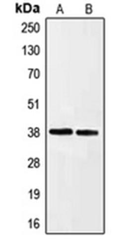 Western blot analysis of HeLa (Lane 1), HepG2 (Lane 2) whole cell lysates using EFNA3 antibody