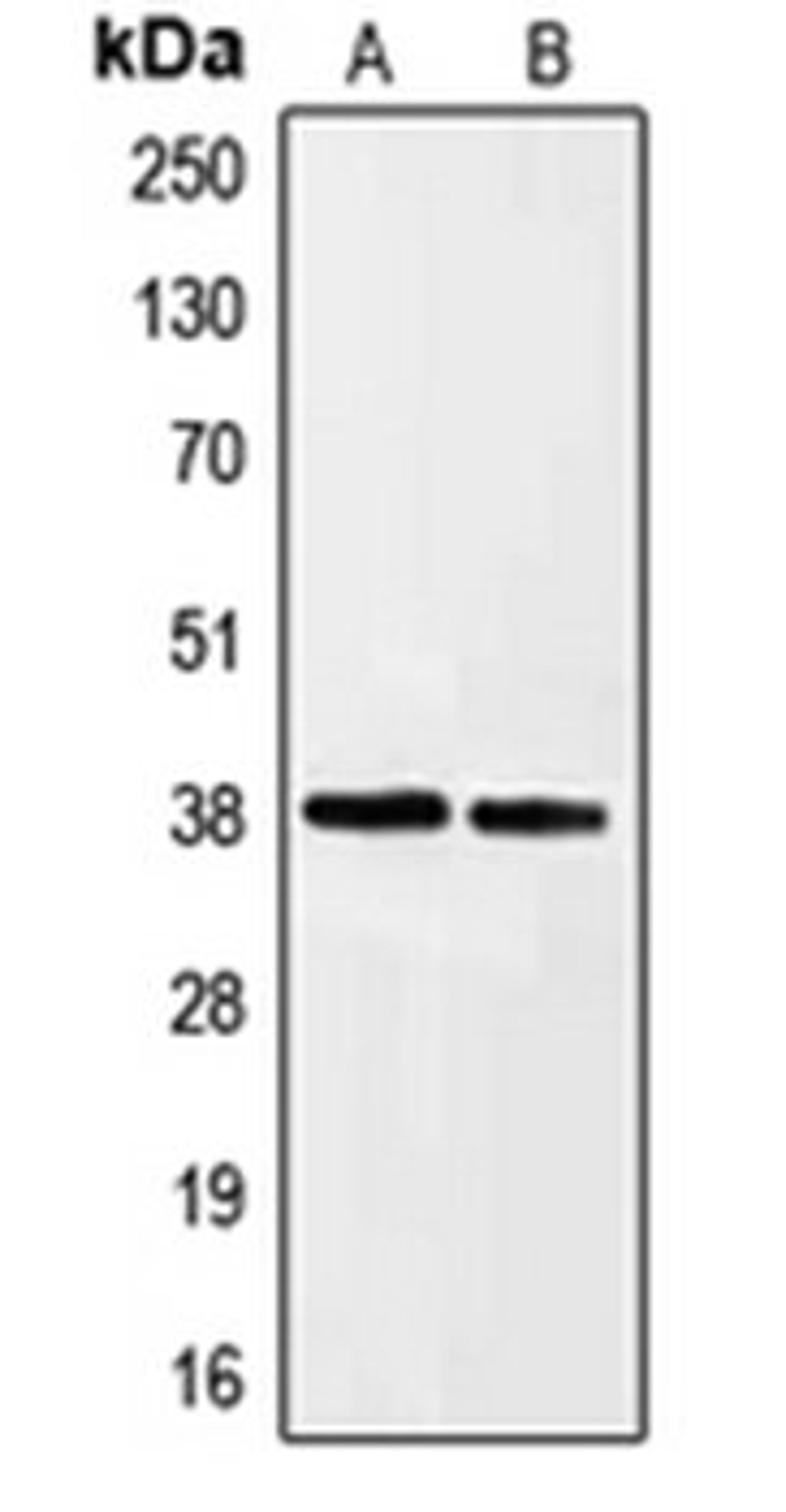 Western blot analysis of HeLa (Lane 1), HepG2 (Lane 2) whole cell lysates using EFNA3 antibody