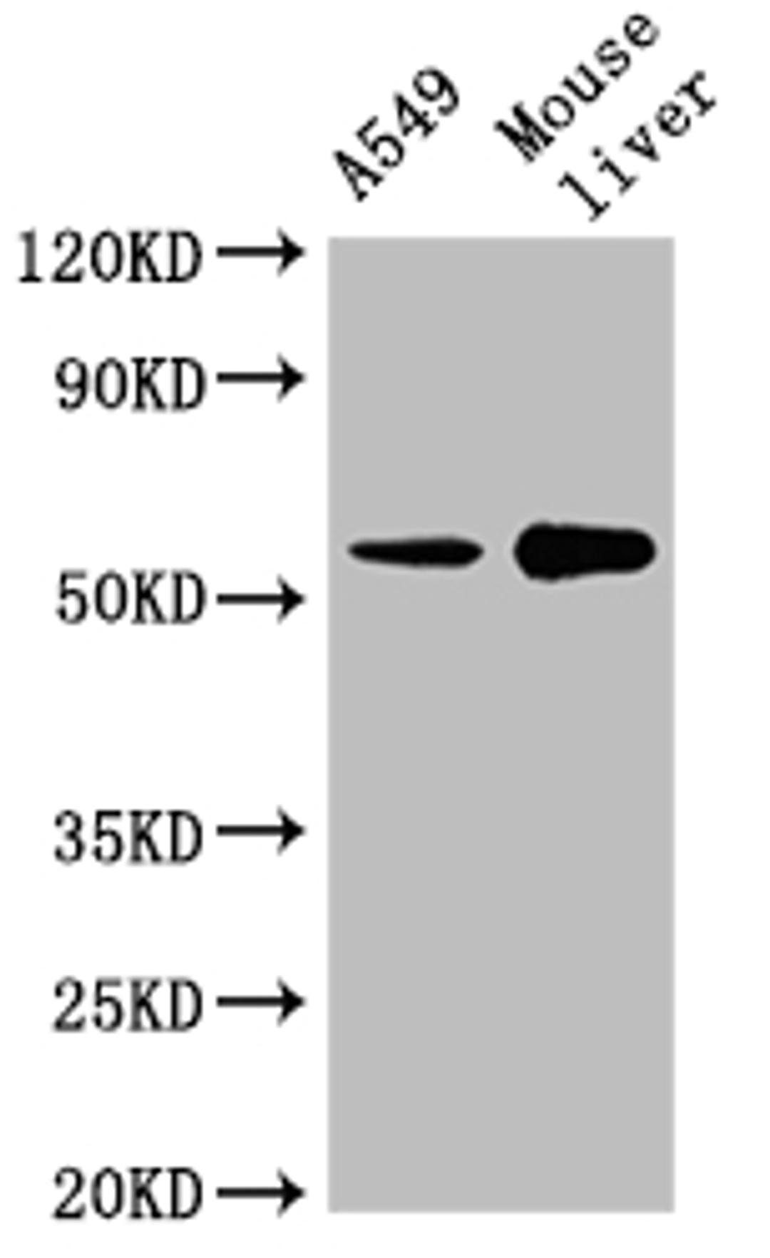 Western Blot. Positive WB detected in: A549 whole cell lysate, Mouse liver tissue. All lanes: CYP2A13 antibody at 1:2000. Secondary. Goat polyclonal to rabbit IgG at 1/50000 dilution. Predicted band size: 57 kDa. Observed band size: 57 kDa. 