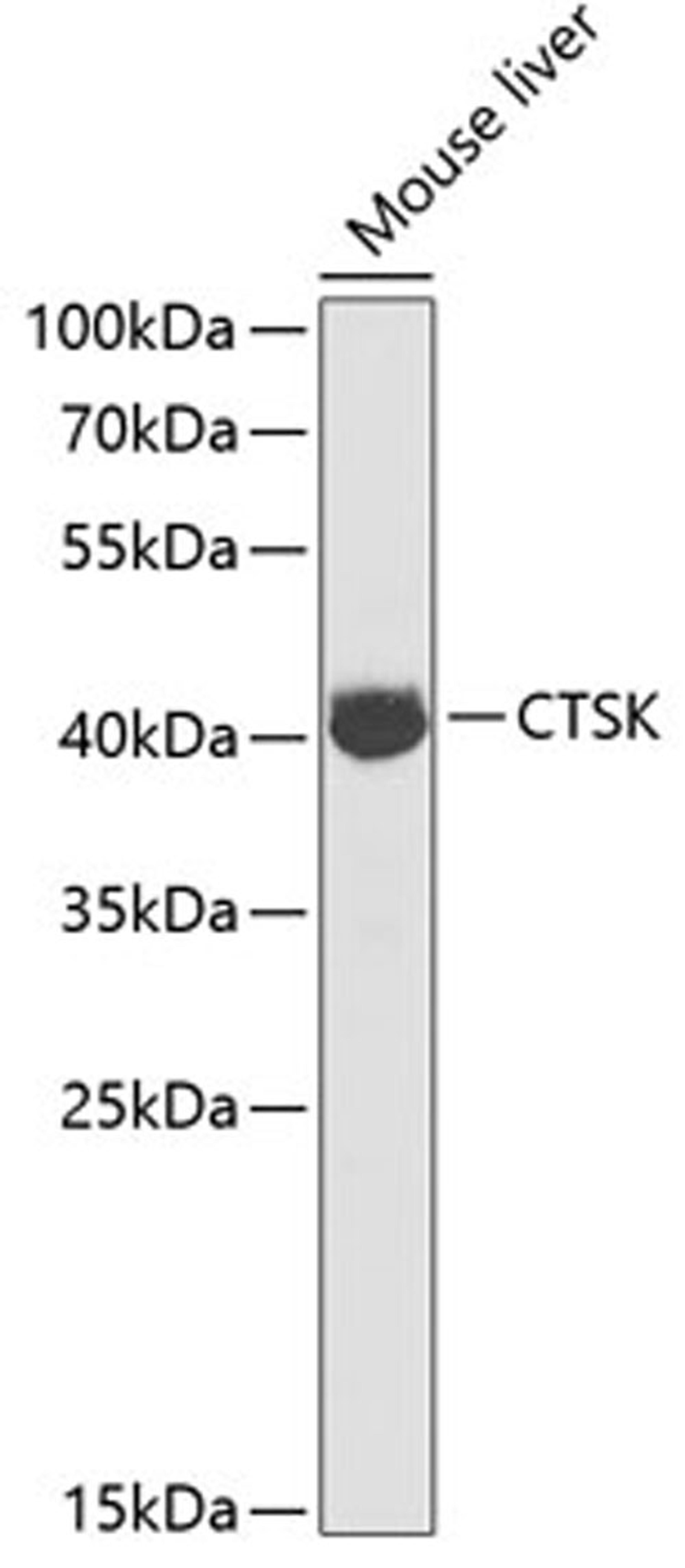 Western blot - CTSK antibody (A1782)