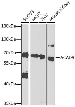 Western blot - ACAD9 antibody (A14121)