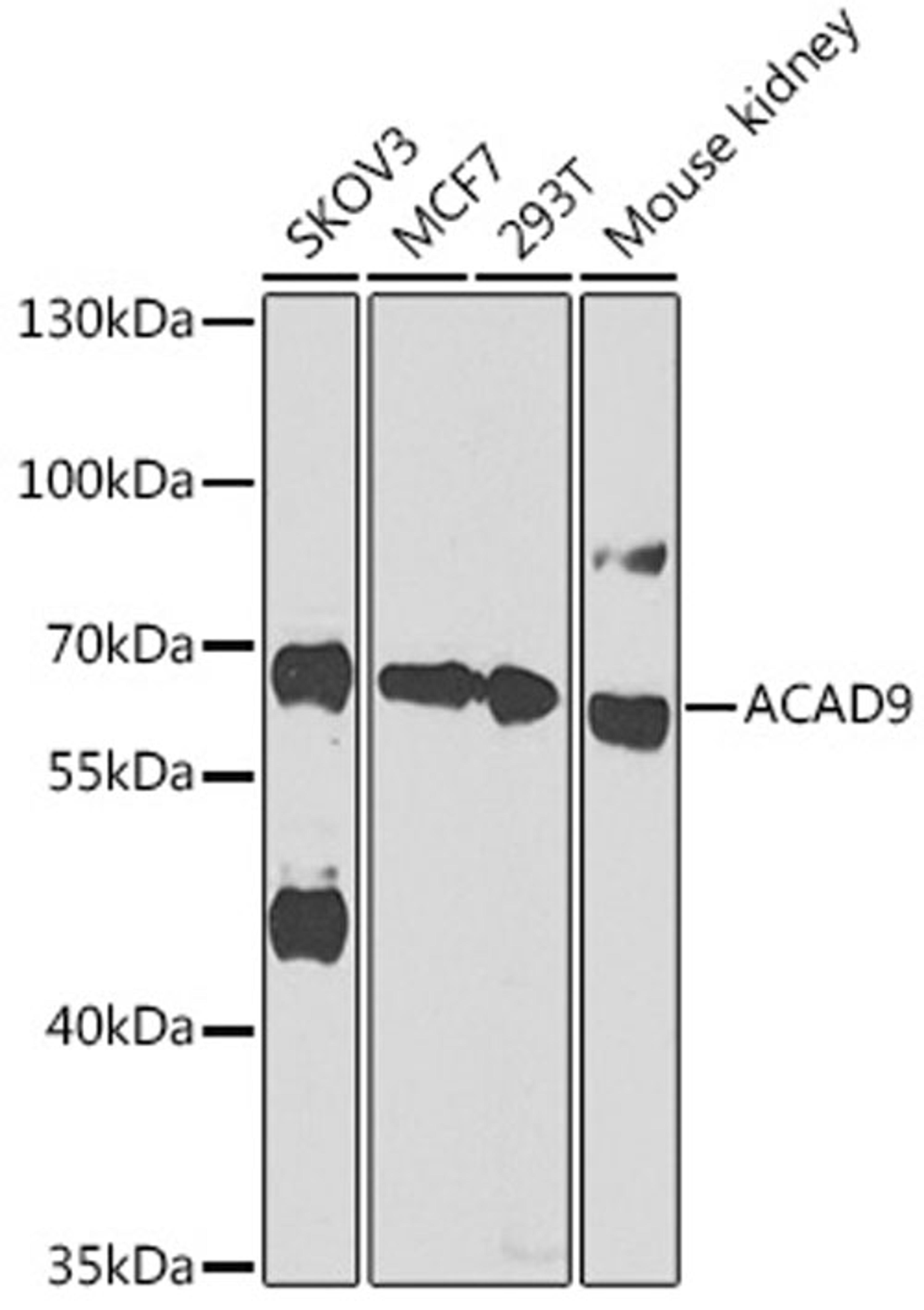 Western blot - ACAD9 antibody (A14121)