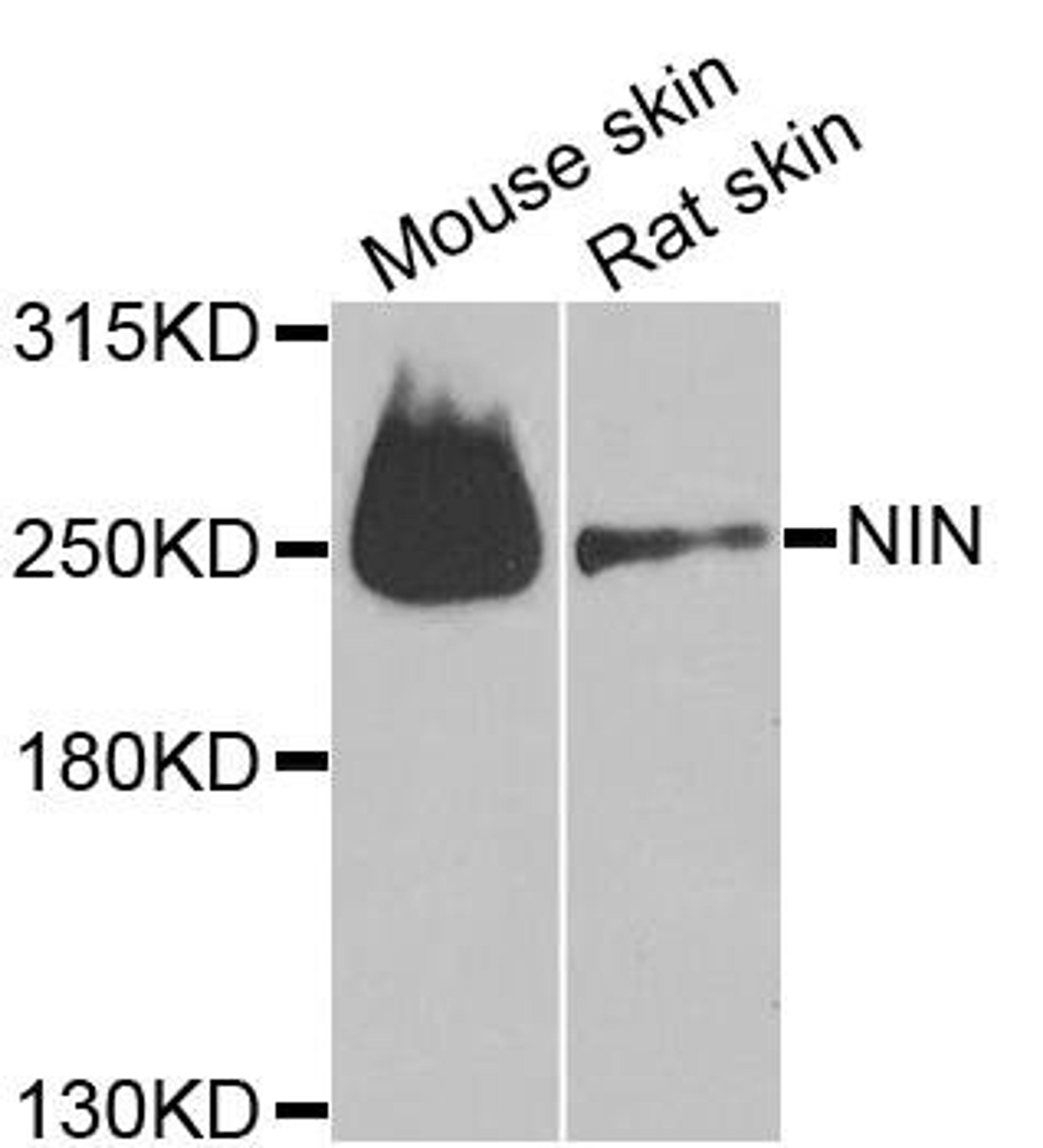 Western blot analysis of extracts of various cell lines using NIN antibody