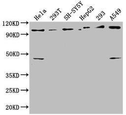 Western Blot. Positive WB detected in: Hela whole cell lysate, 293T whole cell lysate, SH-SY5Y whole cell lysate, HepG2 whole cell lysate, 293 whole cell lysate, A549 whole cell lysate. All lanes: RABEP1 antibody at 1:2500. Secondary. Goat polyclonal to rabbit IgG at 1/50000 dilution. Predicted band size: 100, 96 kDa. Observed band size: 100 kDa