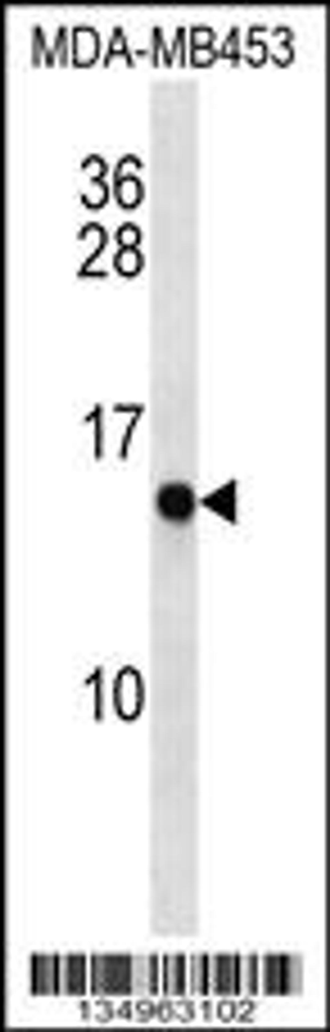 Western blot analysis MDA-MB453 cell line lysates (35ug/lane).