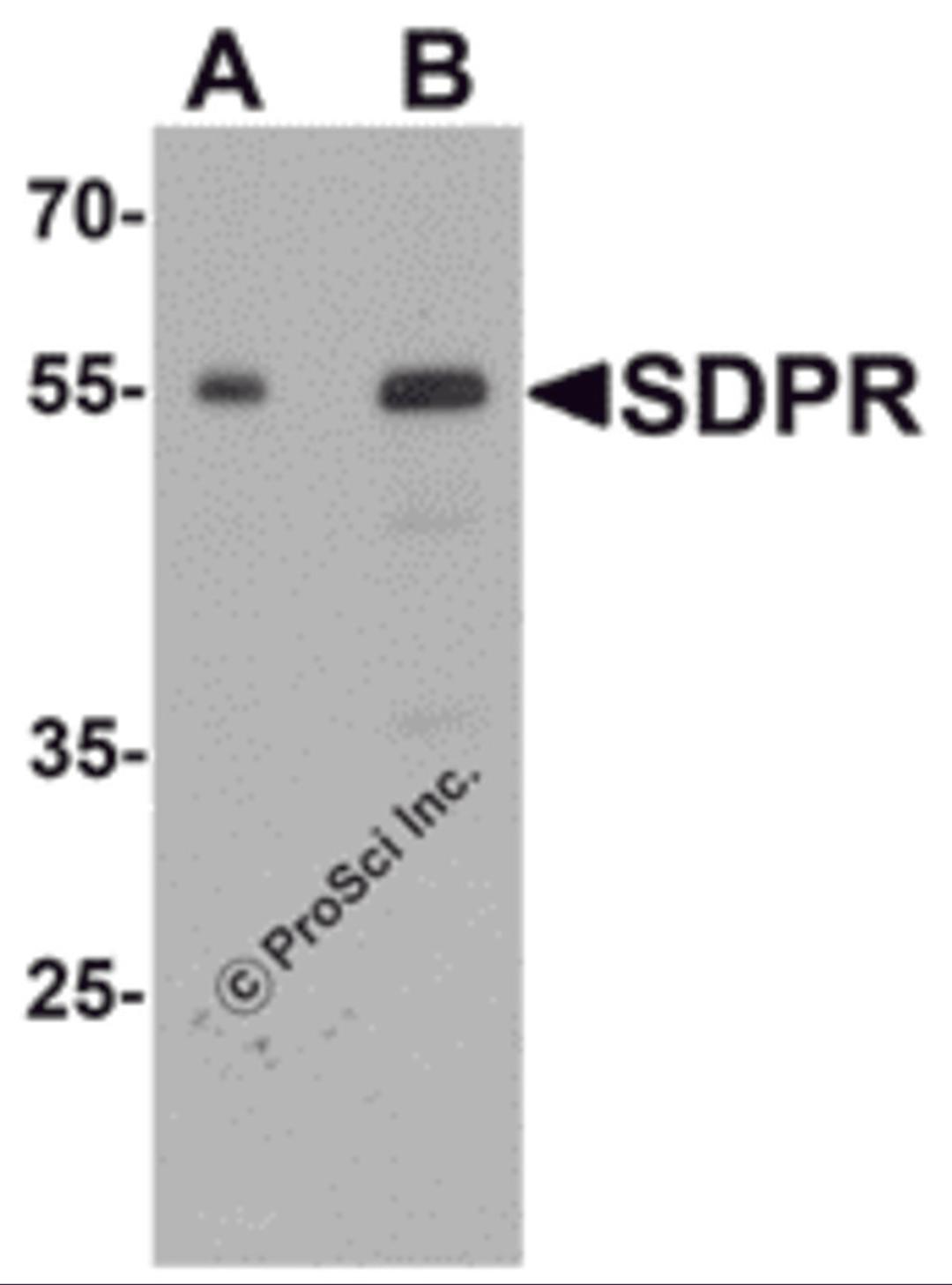 Western blot analysis of PTRF in human spleen tissue lysate with PTRF antibody at (A) 0.5 and (B) 1 μg/mL