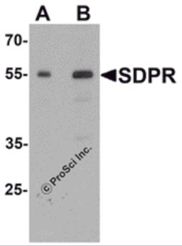Western blot analysis of PTRF in human spleen tissue lysate with PTRF antibody at (A) 0.5 and (B) 1 μg/mL