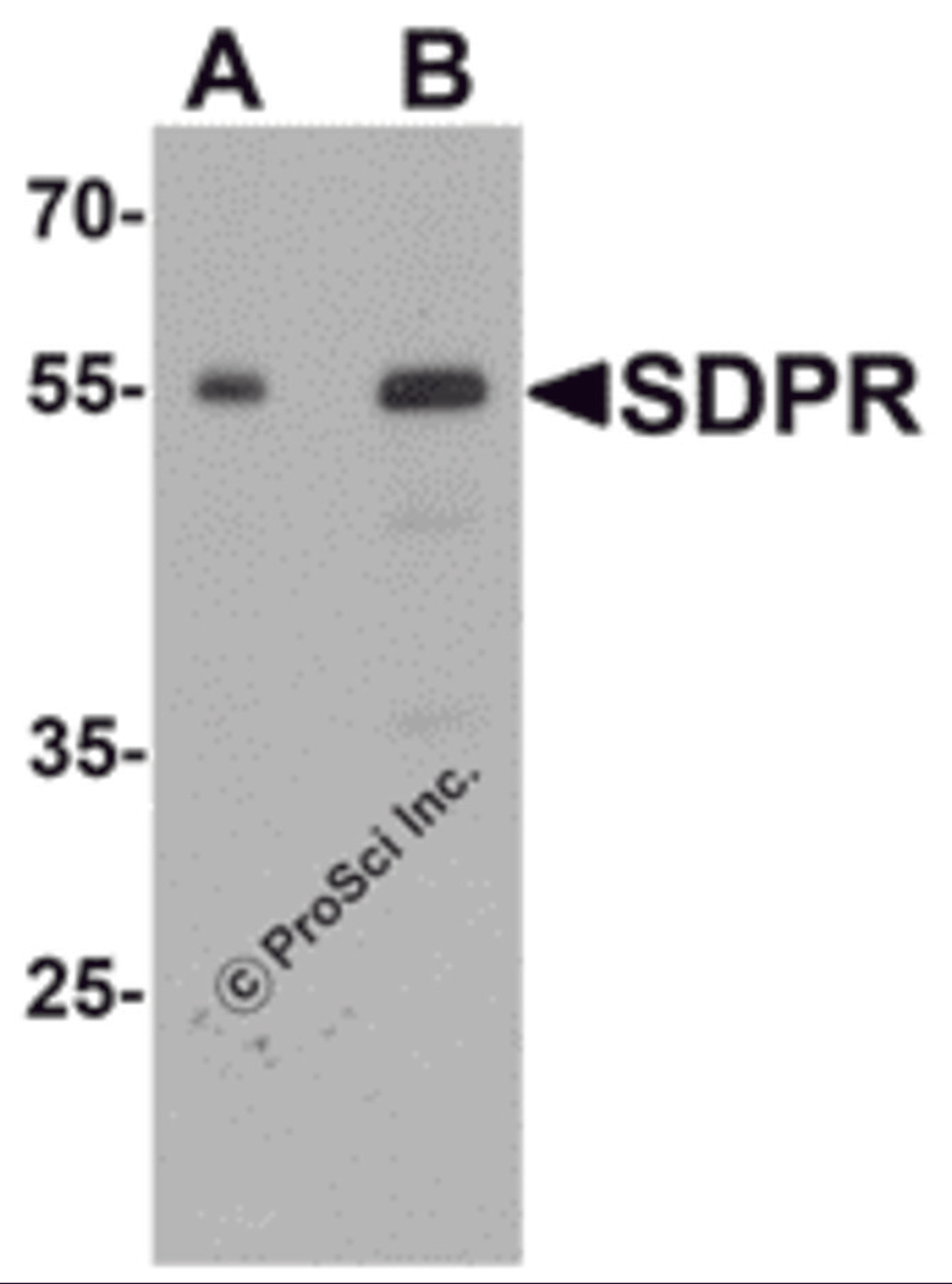 Western blot analysis of PTRF in human spleen tissue lysate with PTRF antibody at (A) 0.5 and (B) 1 μg/mL