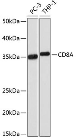 Western blot - CD8A  Rabbit mAb (A0663)