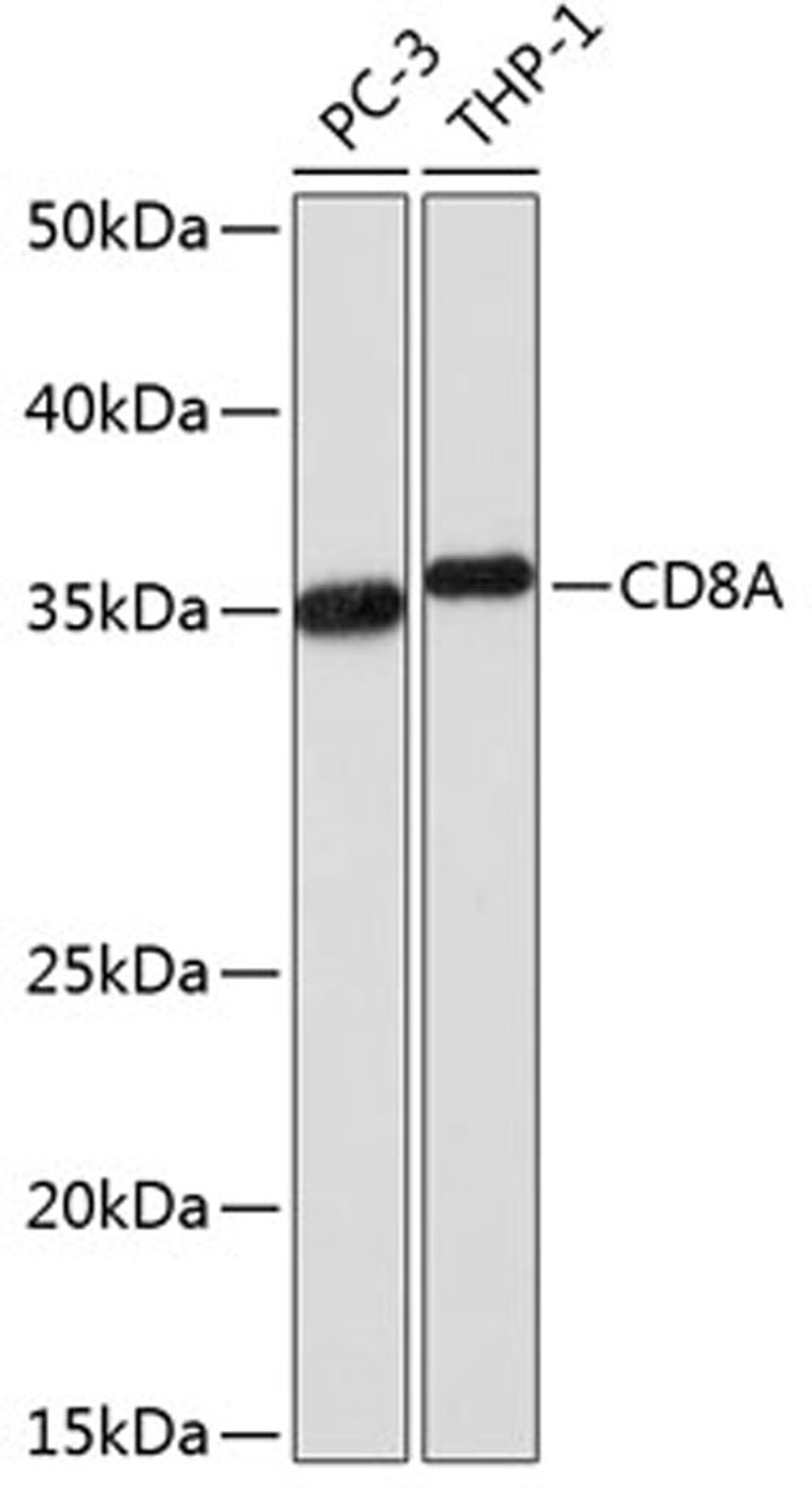 Western blot - CD8A  Rabbit mAb (A0663)