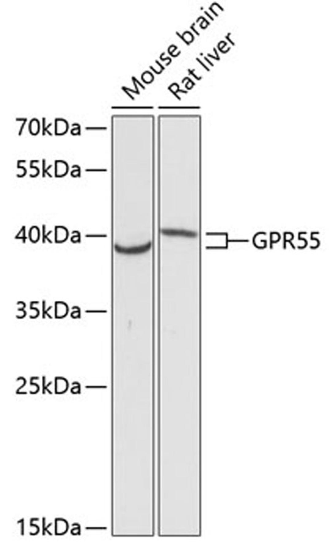 Western blot - GPR55 antibody (A12890)