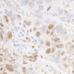 Detection of human Cyclin C by immunohistochemistry.