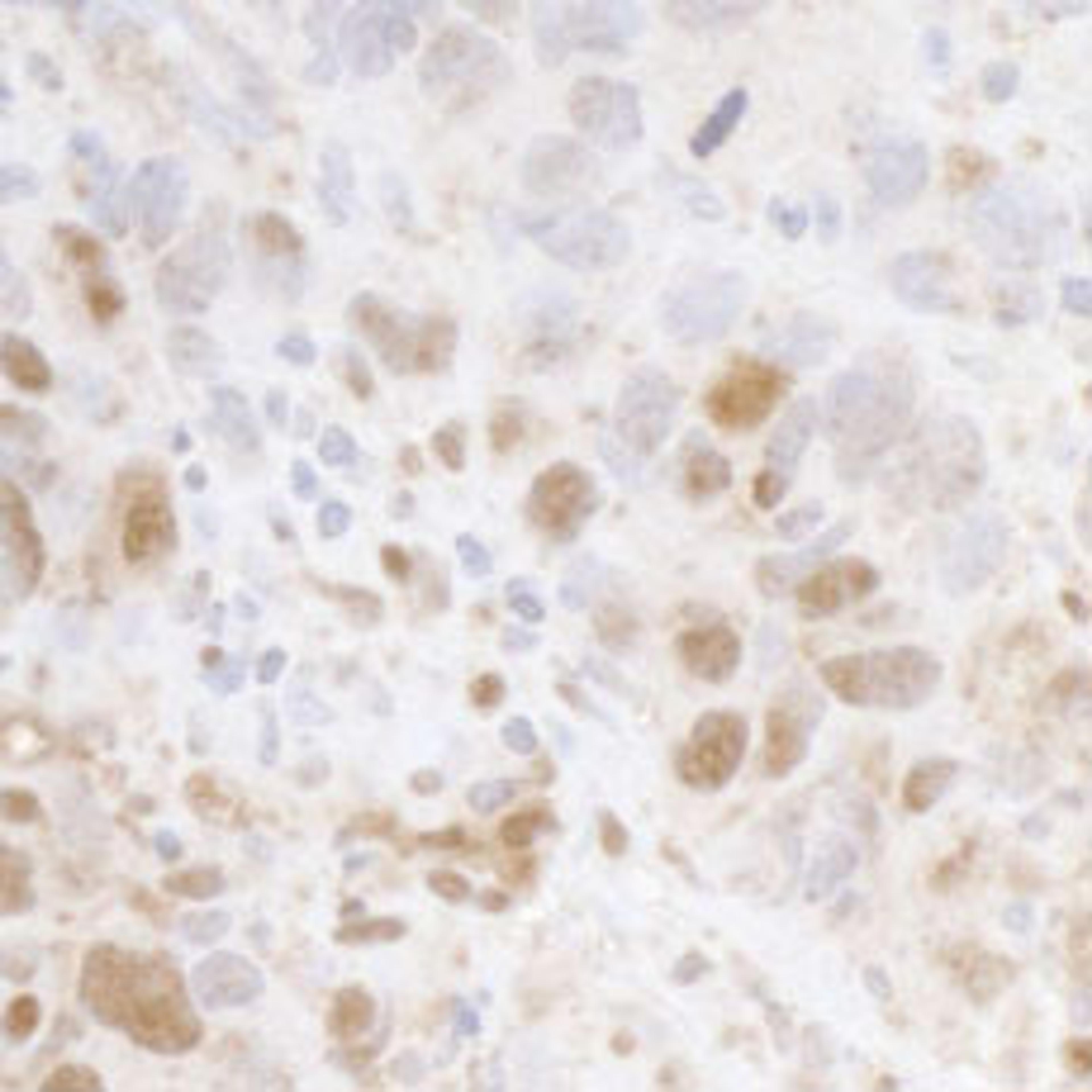 Detection of human Cyclin C by immunohistochemistry.