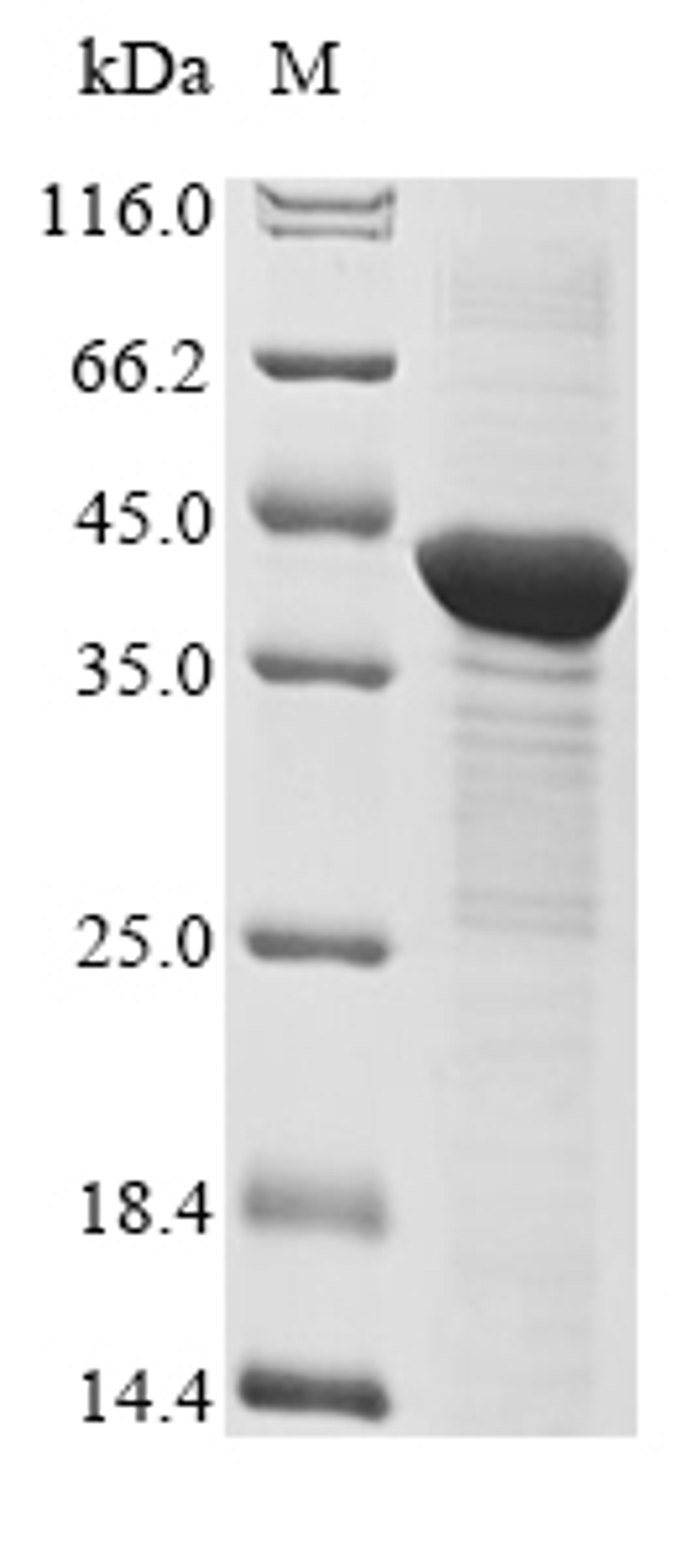 (Tris-Glycine gel) Discontinuous SDS-PAGE (reduced) with 5% enrichment gel and 15% separation gel.