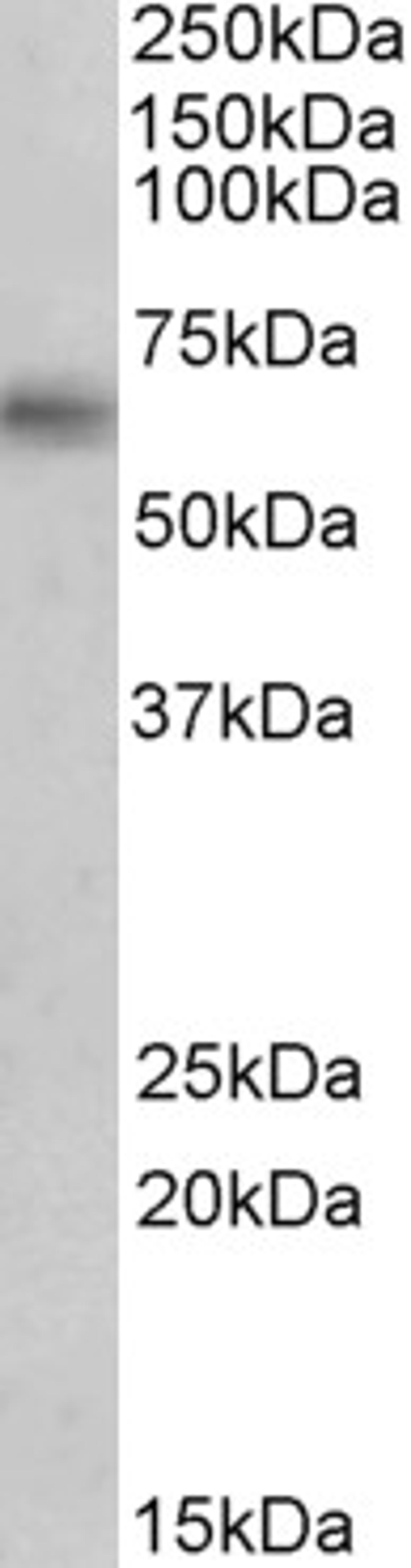 45-862 (0.5ug/ml) staining of Human Brain (Hippocampus) lysate (35ug protein in RIPA buffer). Primary incubation was 1 hour. Detected by chemiluminescence.