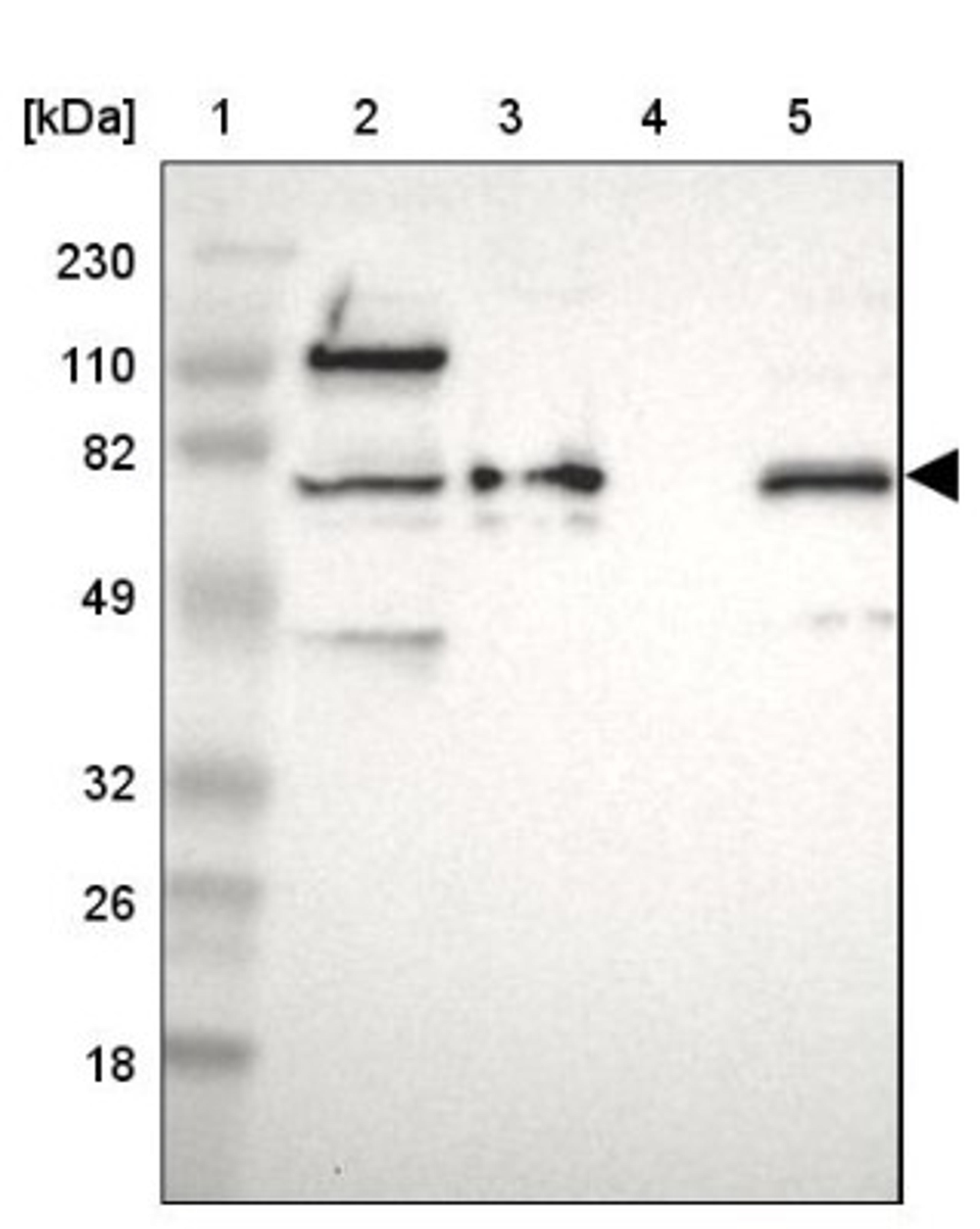 Western Blot: Merlin Antibody [NBP1-87757] - Lane 1: Marker [kDa] 230, 110, 82, 49, 32, 26, 18<br/>Lane 2: Human cell line RT-4<br/>Lane 3: Human cell line U-251MG sp<br/>Lane 4: Human plasma (IgG/HSA depleted)<br/>Lane 5: Human liver tissue