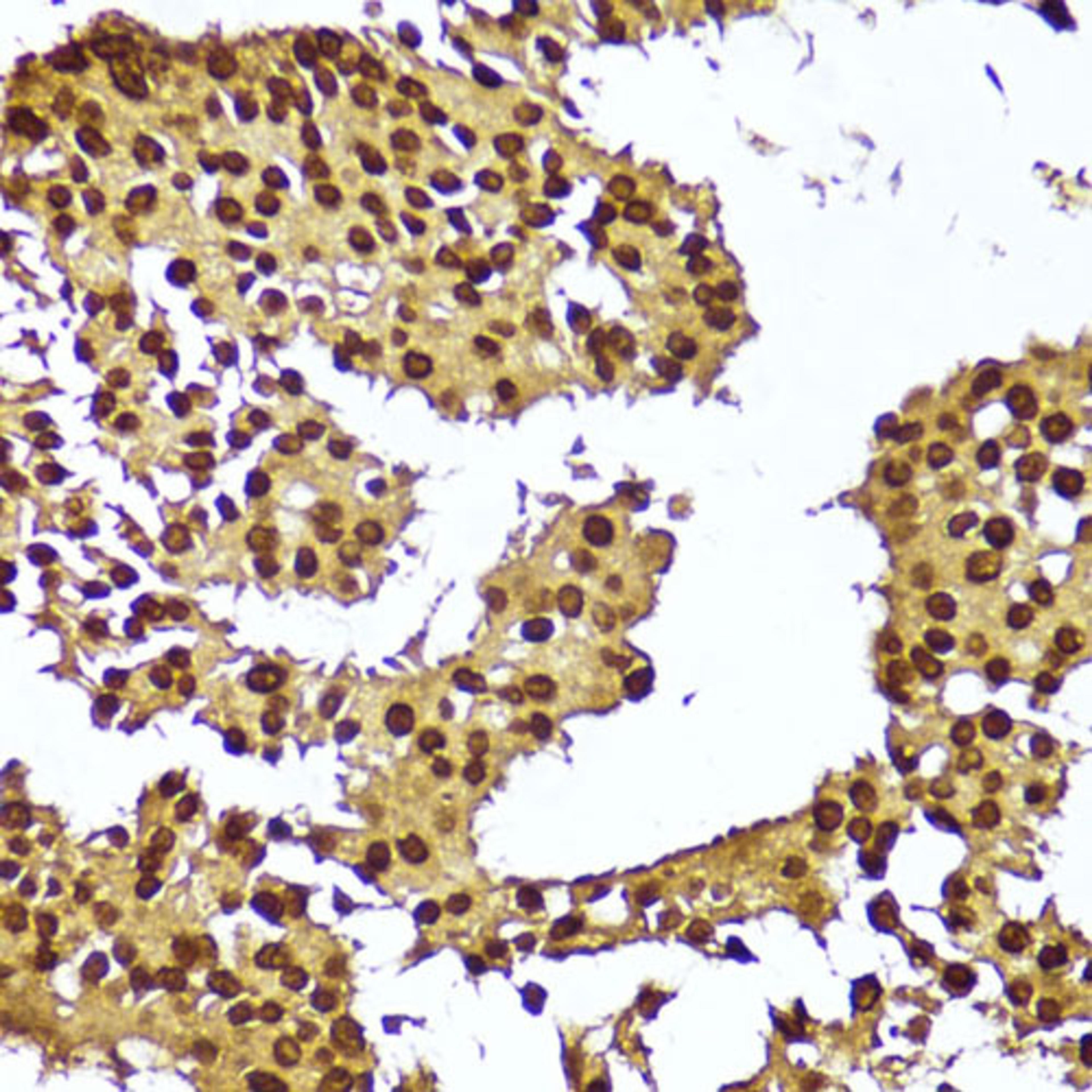 Immunohistochemistry - TERT antibody (A16625)