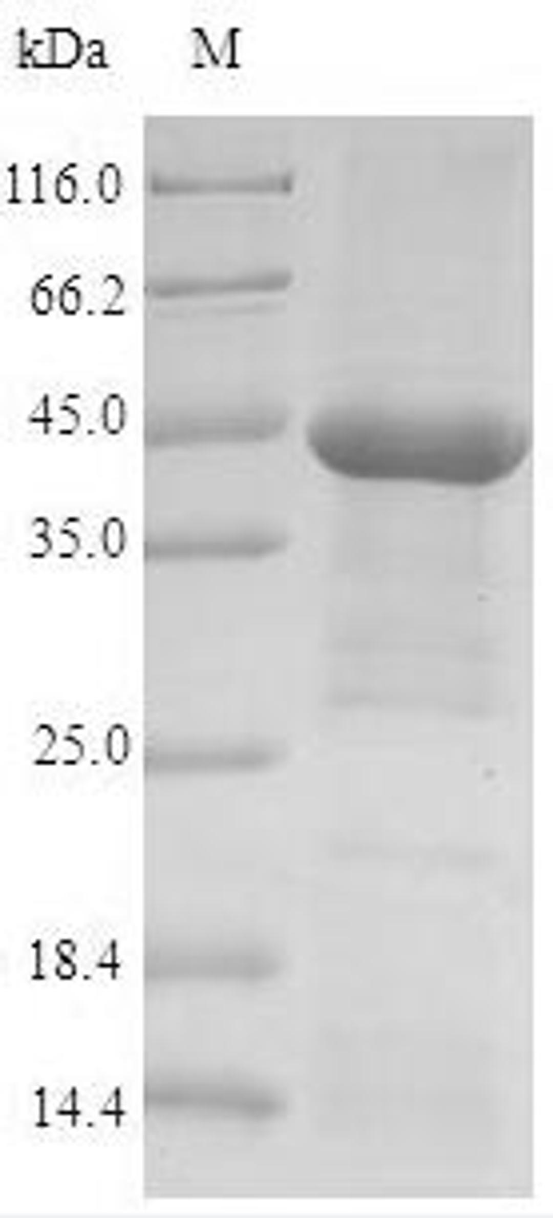 (Tris-Glycine gel) Discontinuous SDS-PAGE (reduced) with 5% enrichment gel and 15% separation gel.