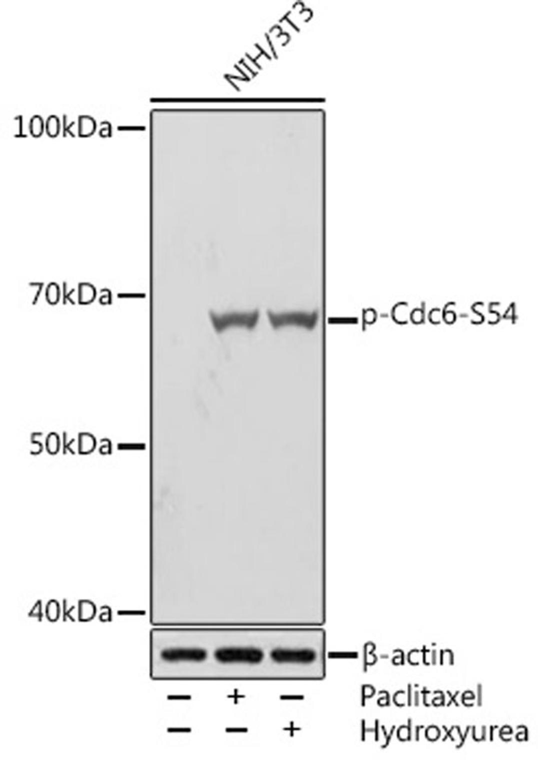 Western blot - Phospho-Cdc6-S54 Rabbit mAb (AP1153)