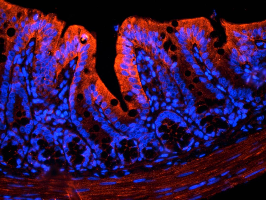 IF analysis of rat colon tissue using IGF1 antibody (2.5 ug/ml)